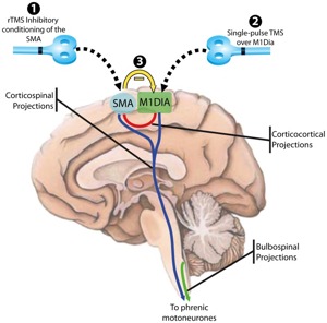 TMS brain diagram - www.24-7Press